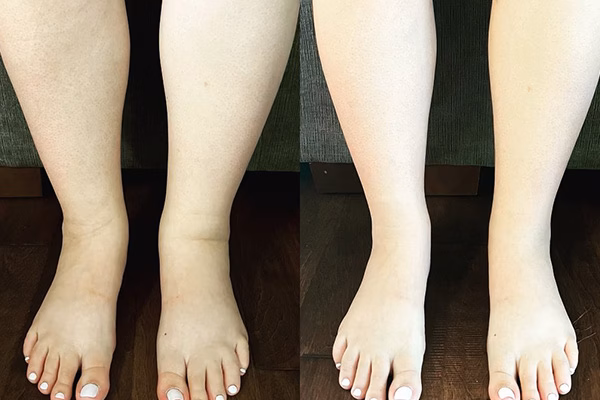 Before and after: Faster Recovery with Rapid Reboot